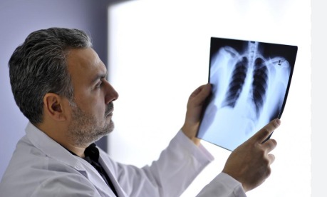 Doctor examining chest X-ray highlighting bacterial lung infection in a North Indian hospital