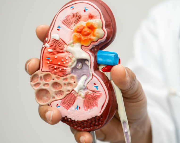 Doctor explaining chronic kidney disease risks to patient in India