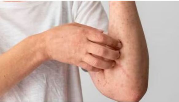 fungal-infection-research-labs-india