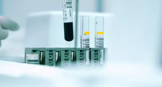 Diagram showing the rare Rh-null or Golden Blood type and its absence of Rh antigens